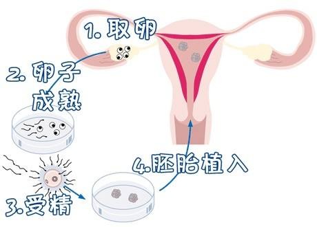 院长